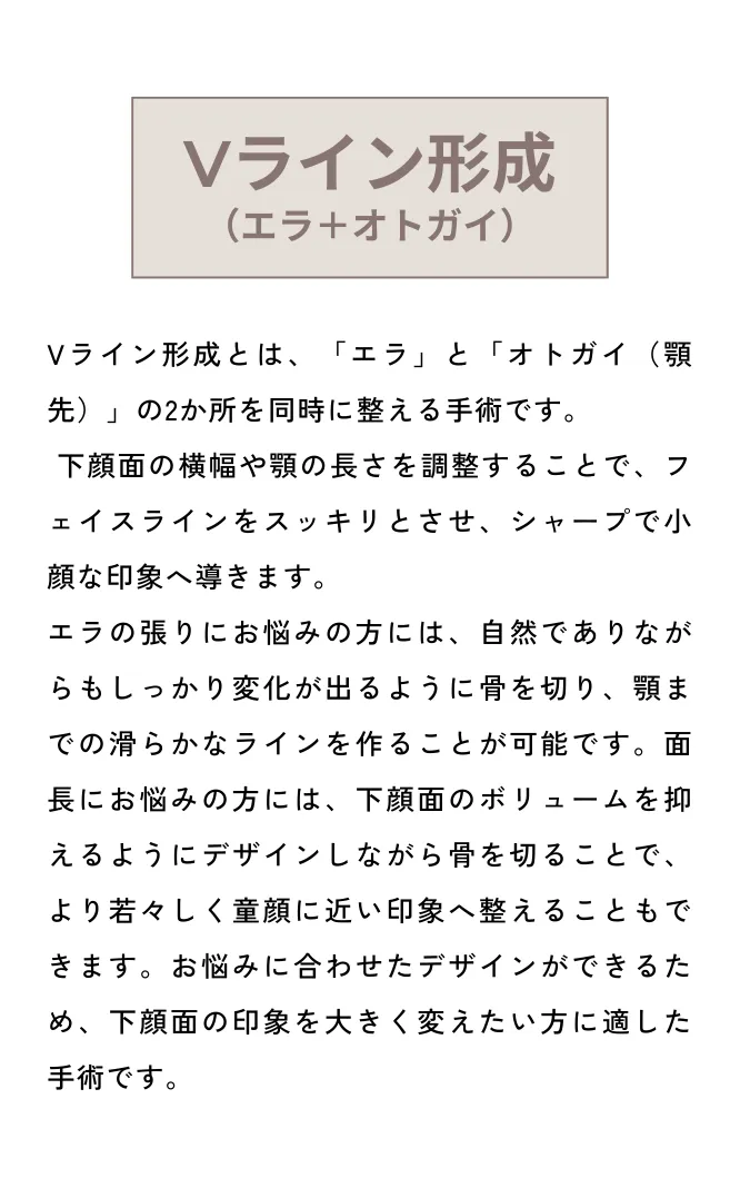 Vライン形成＋外板除去