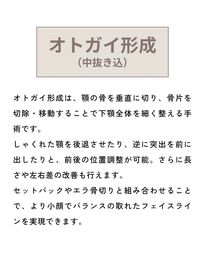オトガイ形成＋外板除去
