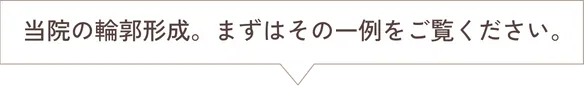当院の輪郭形成。まずはその一例をご覧ください。