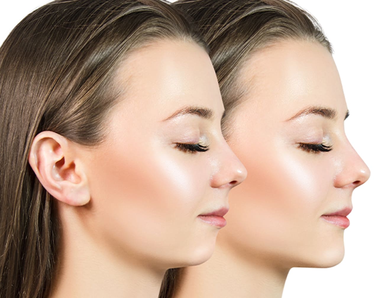 渋谷 美容外科 美容皮膚科 アーククリニック 美容外科キャンペーン